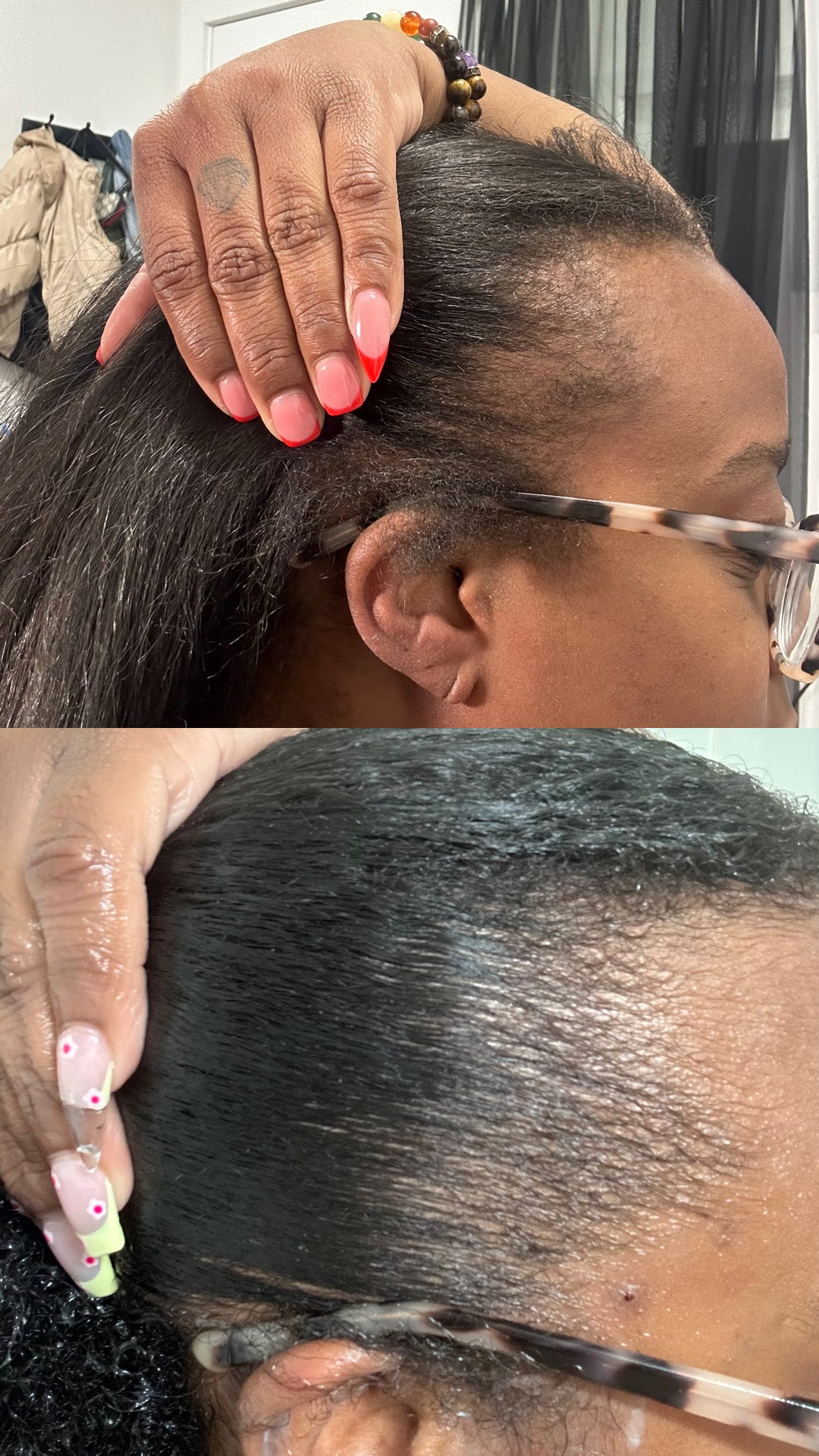 KELI Hair Growth Oil